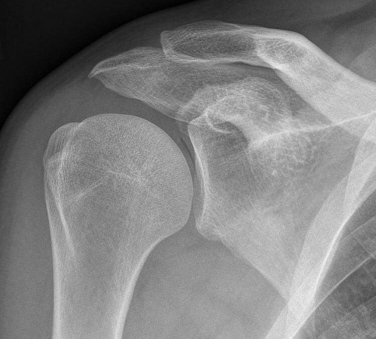Shoulder Anatomy